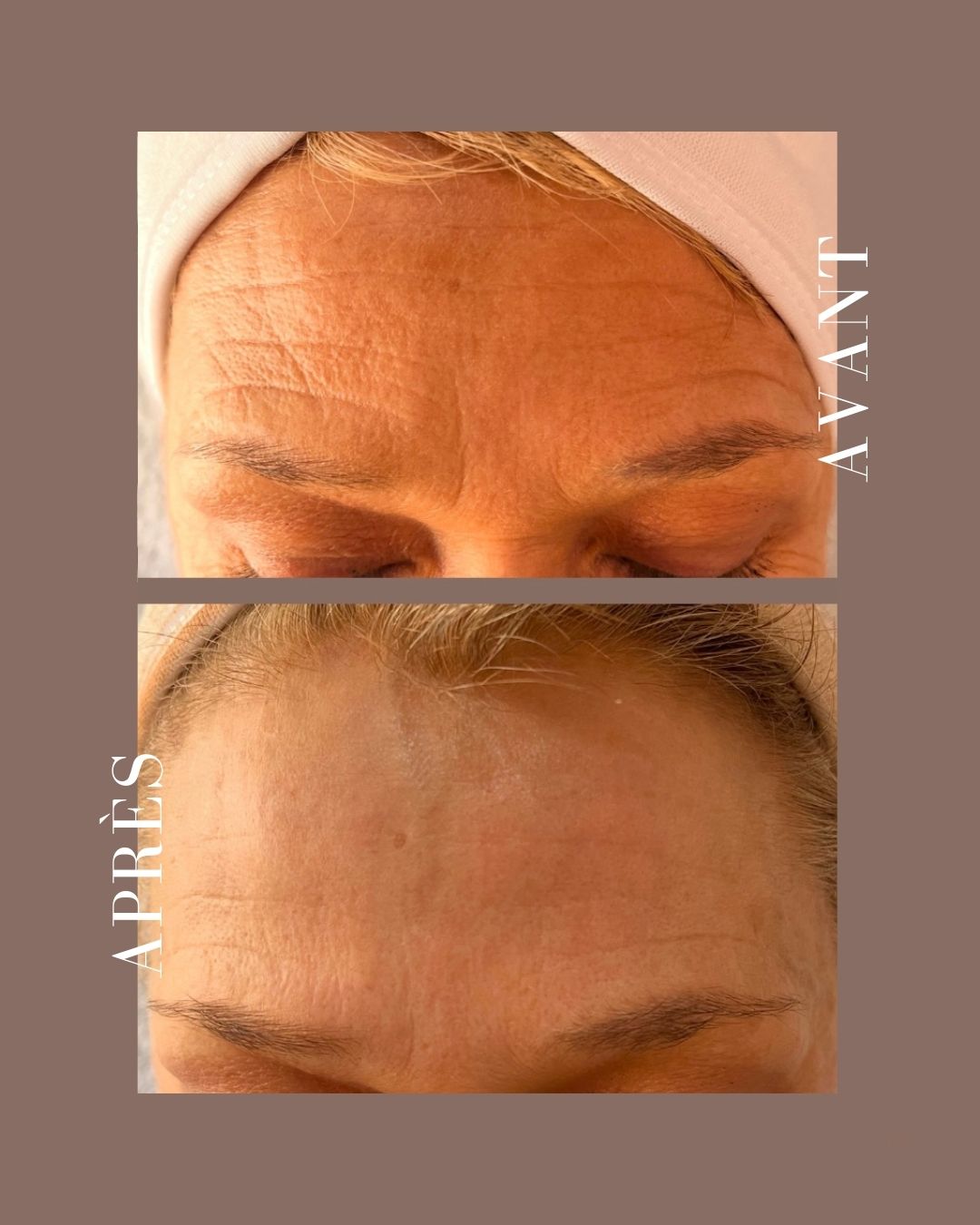 gua sha